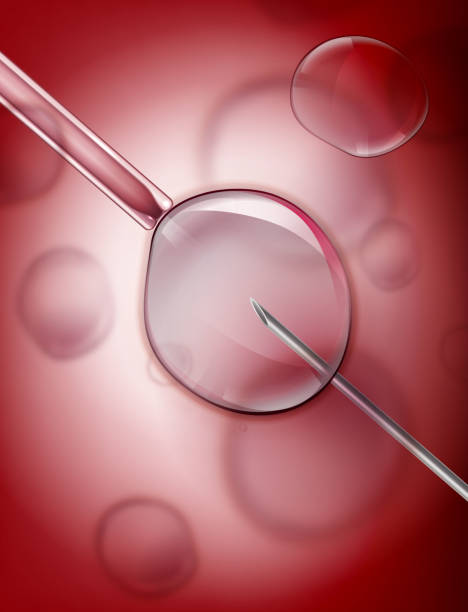 Understanding IVF Process