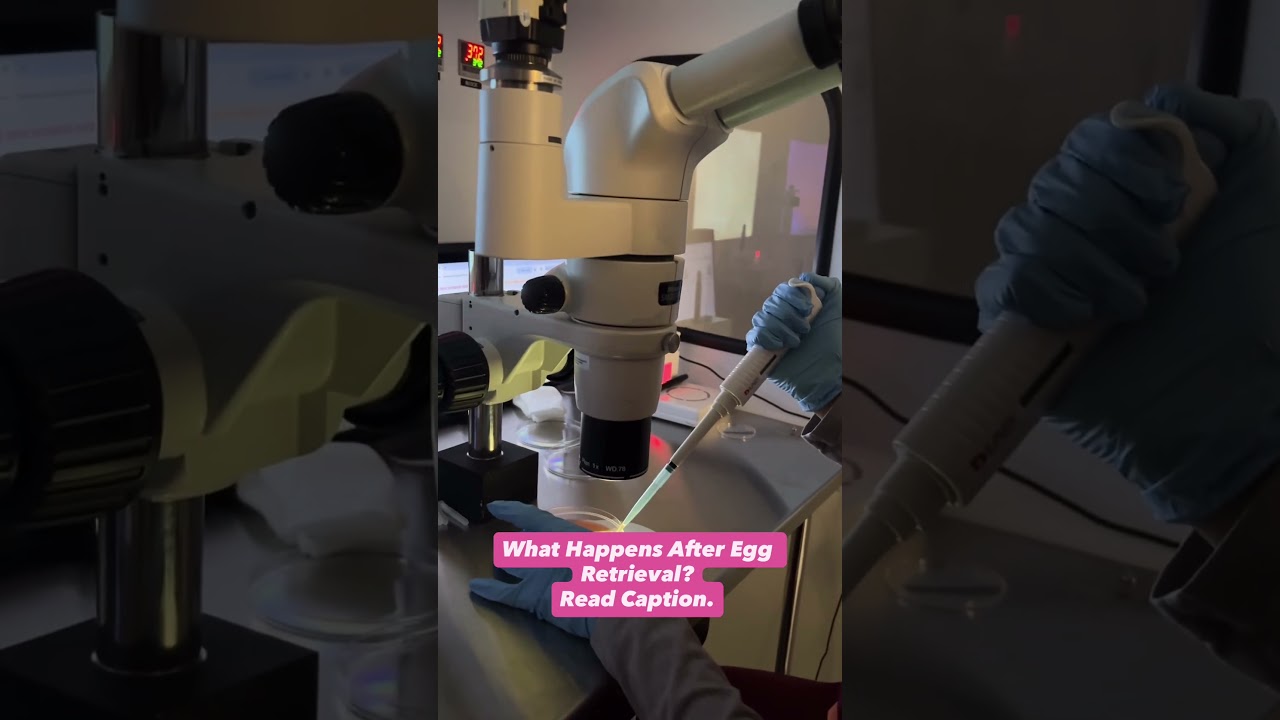 After egg retrieval? Read Caption.
