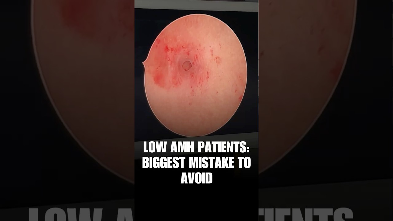 The Real Reason Behind Low AMH!