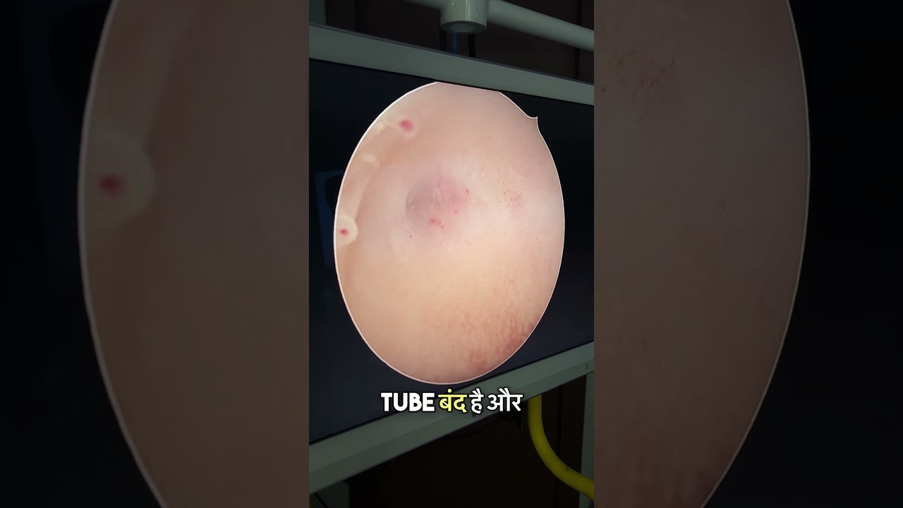 The Hidden Infection Causing Infertility