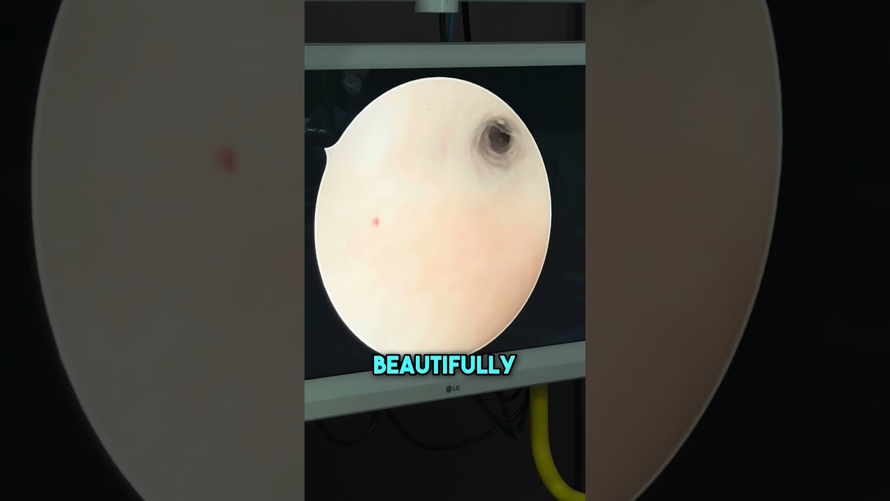 Tubal Block Treatment!