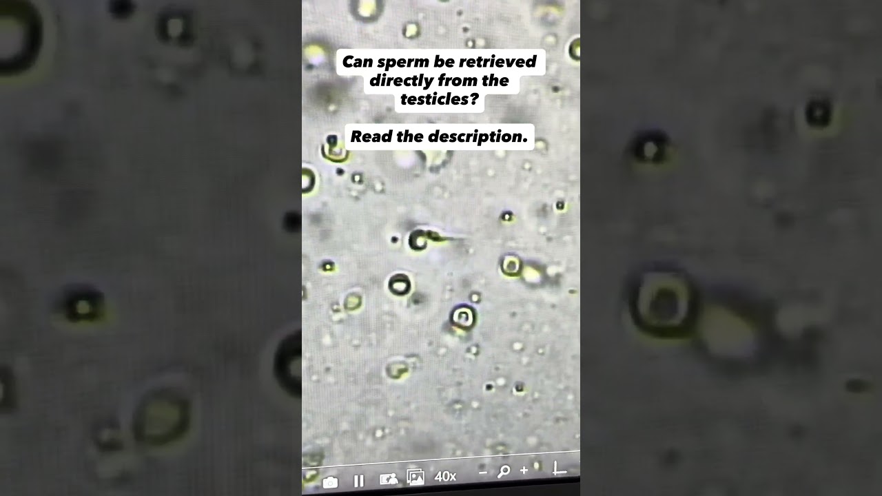 Can sperm be retrieved directly from the testicles?