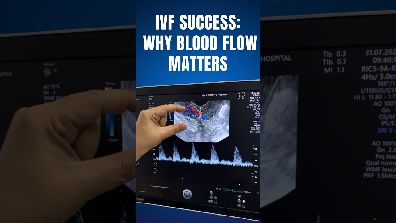 Why Uterine Artery Doppler Matters in IVF