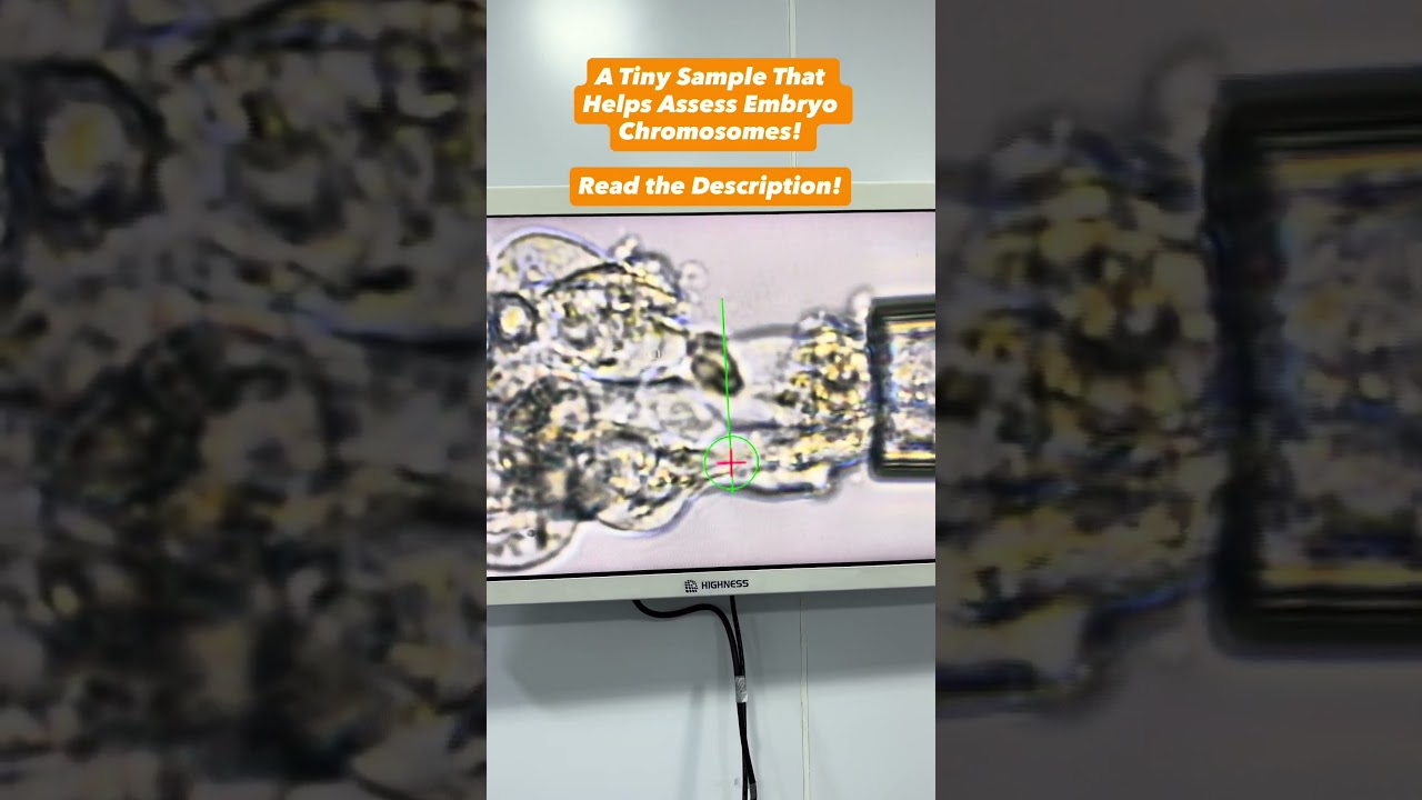 A Tiny Sample That Helps Assess Embryo Chromosomes