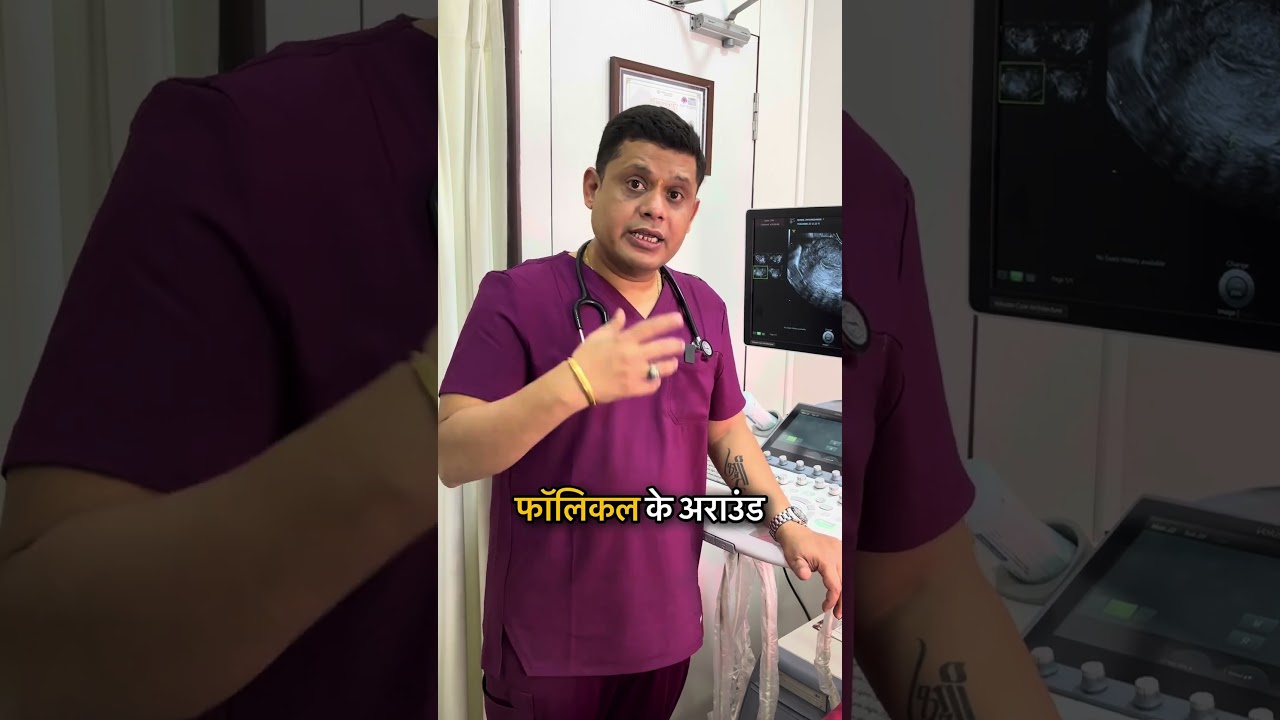 Fertility Scans Explained!