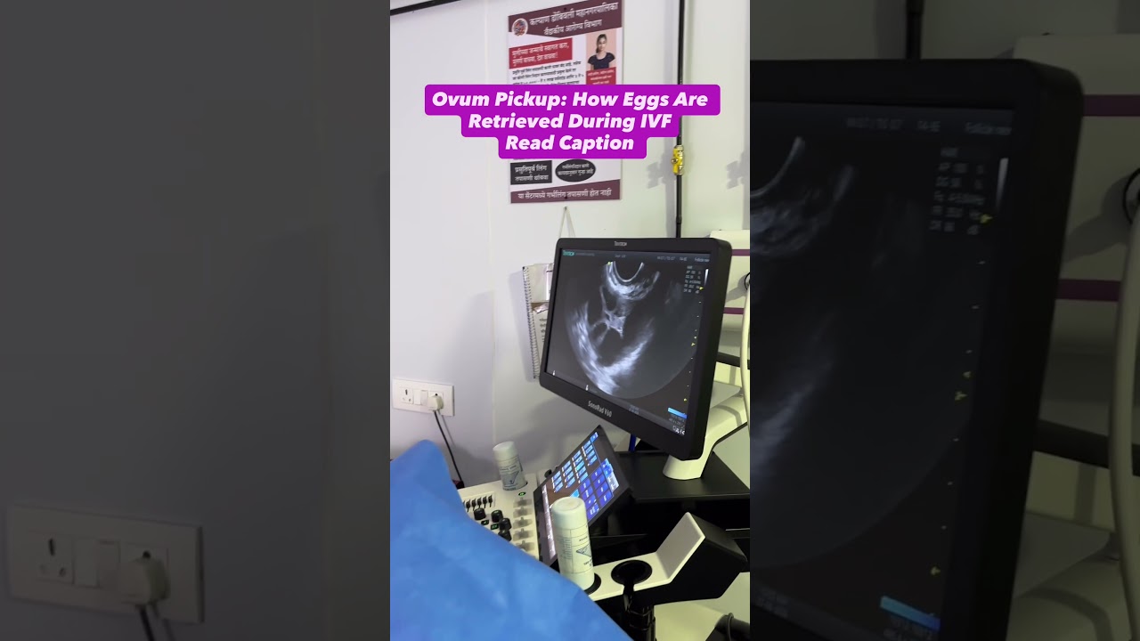 Ovum Pickup (OPU)