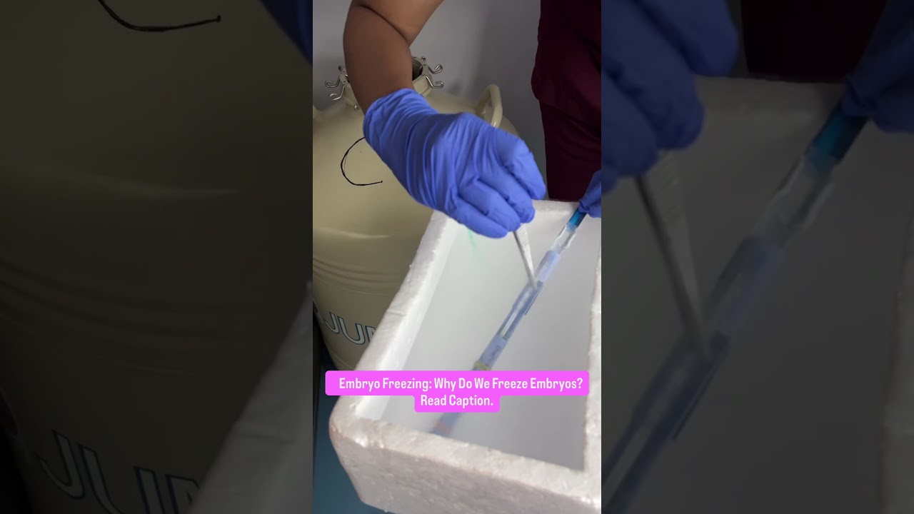 Embryo Freezing: How Does It Work in IVF?