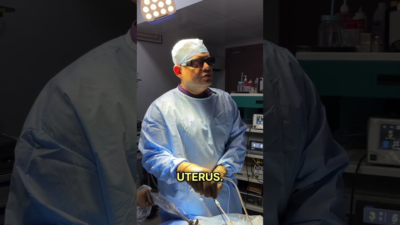Microwave Ablation for Adenomyosis